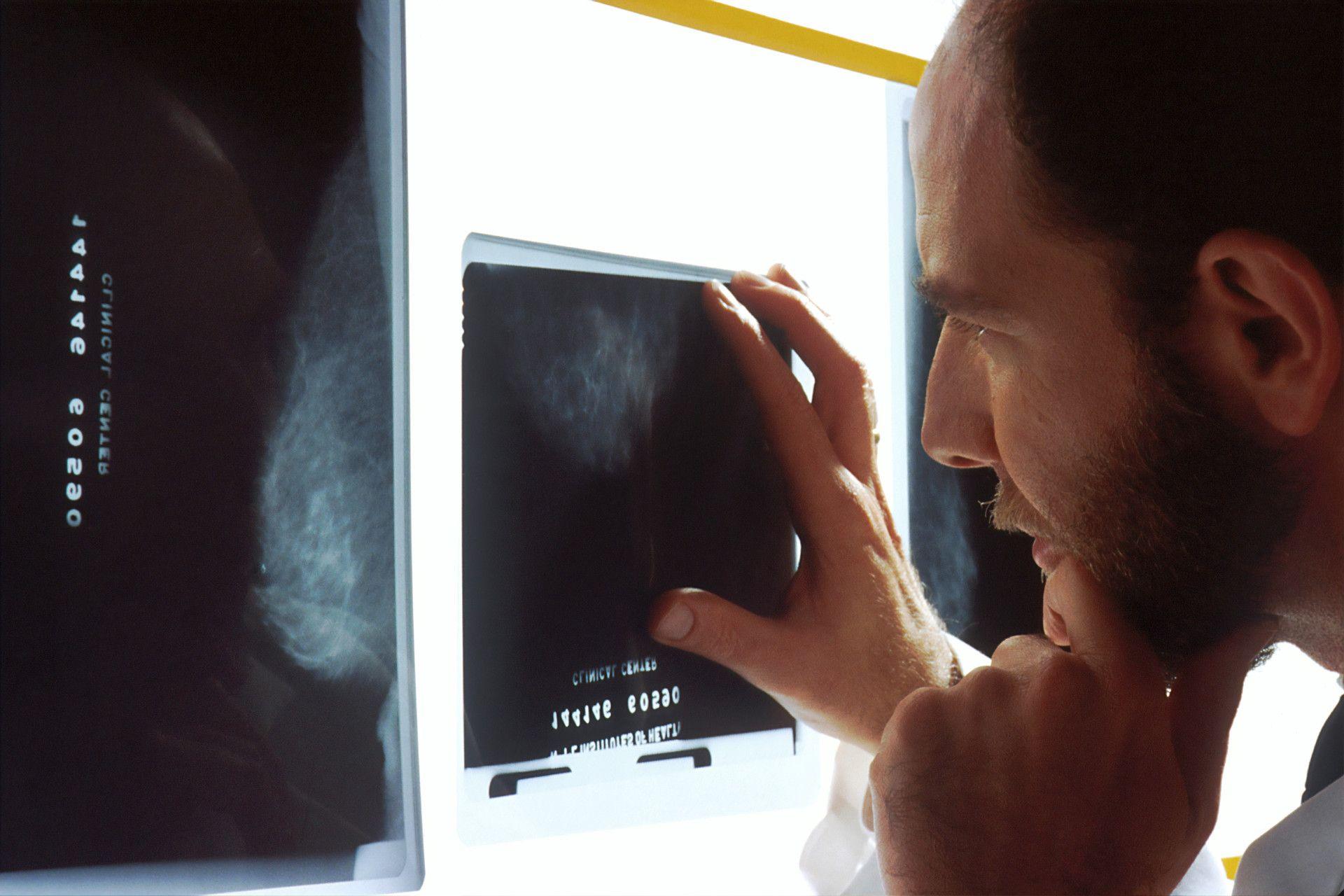 AI meets non-invasive care